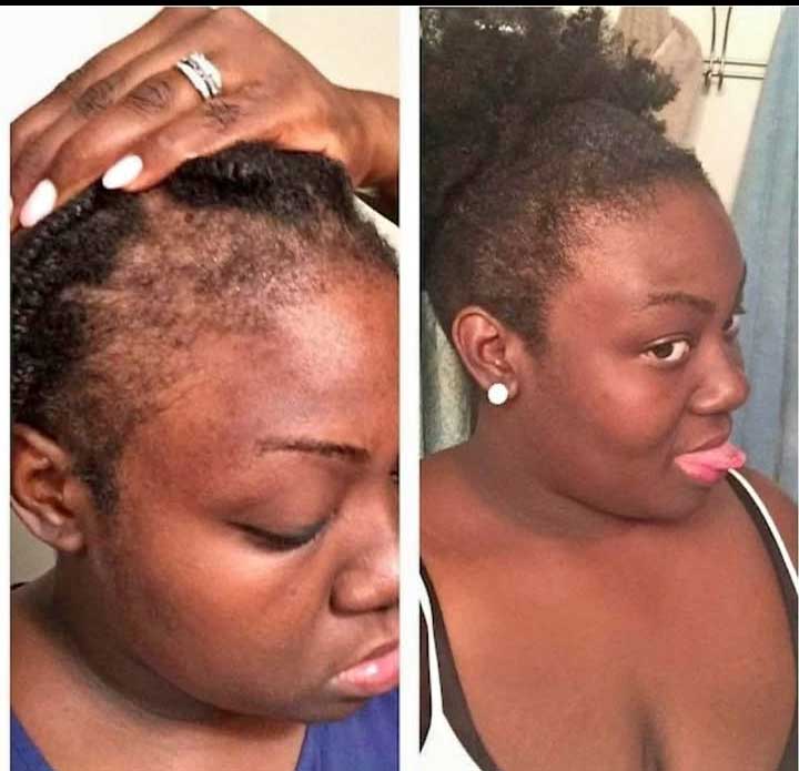 Afro Booster, Pousse cheveux - Rapide